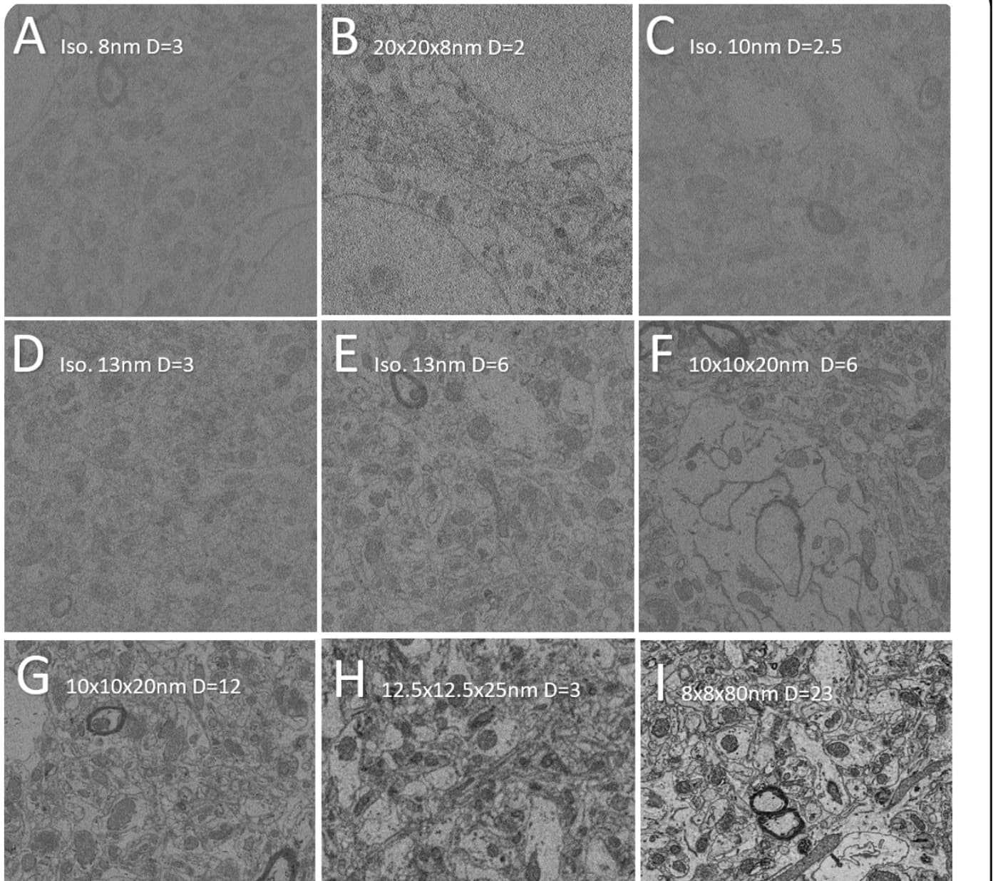 Representative SBF-SEM sections from each acquisition