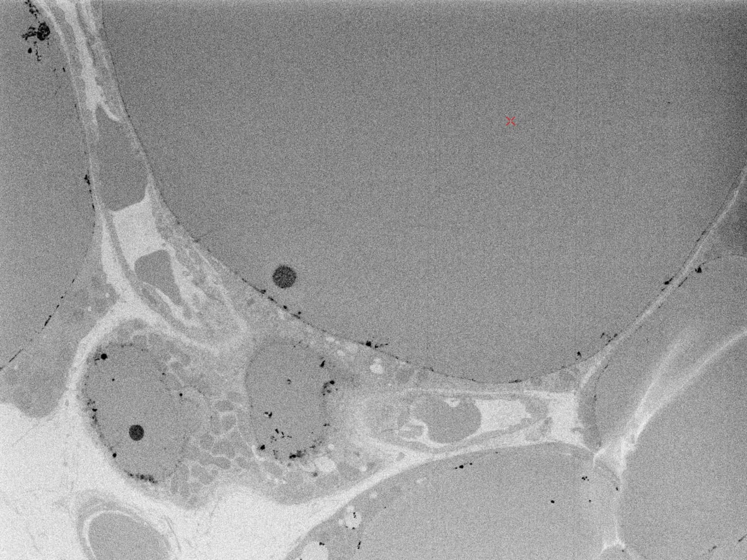 With charge neutralisation — clean, artifact-free imaging