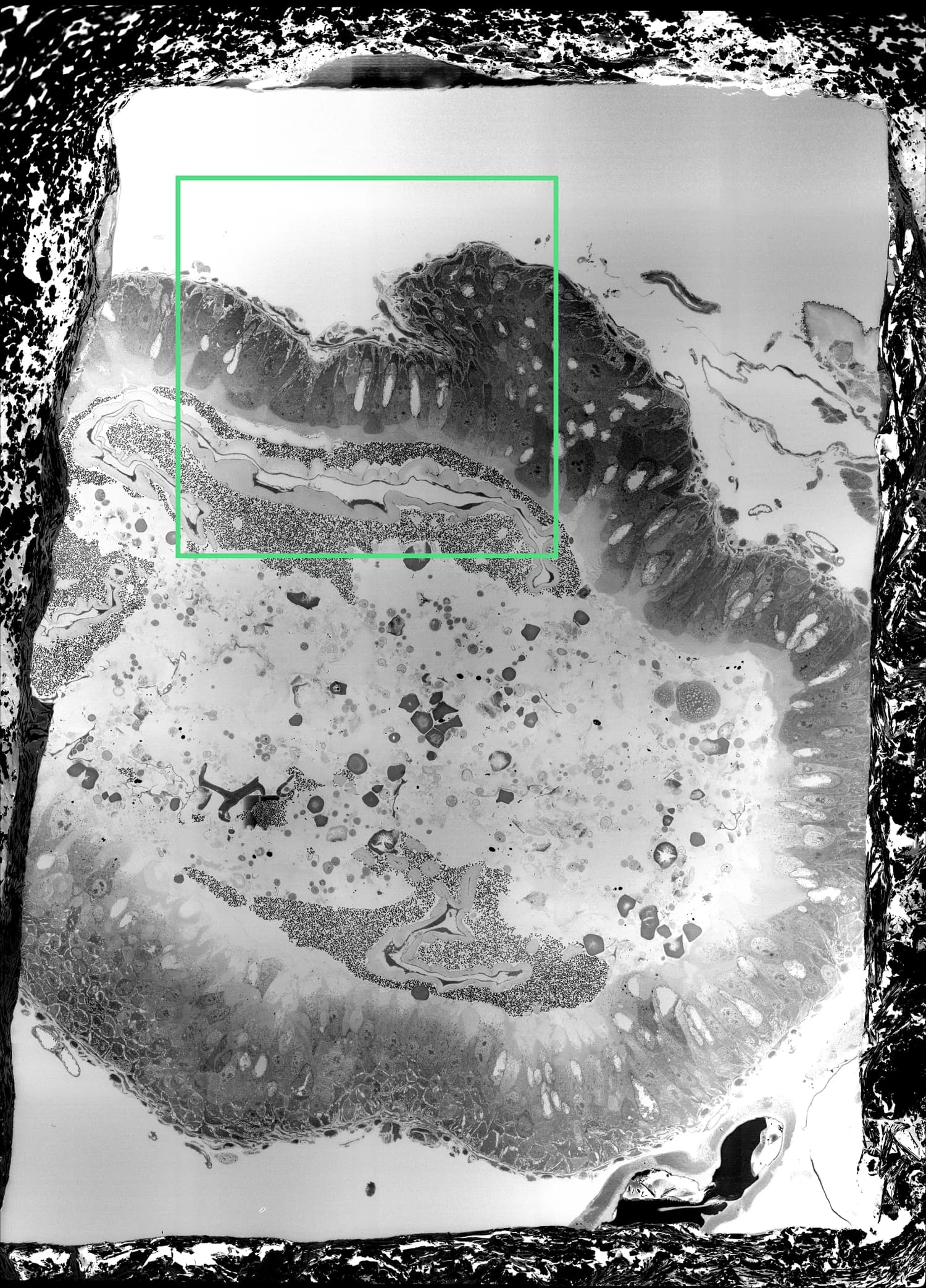 The 2x2 block located within the main mosaic