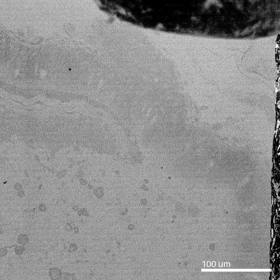 The PCN needle tip over the imaged region